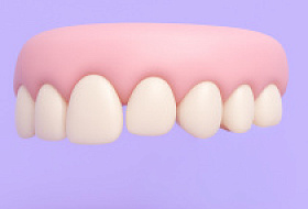 Небная дистопия верхнего клыка: ранняя диагностика и превентивная коррекция