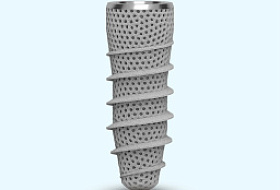 3D-печатные титановые зубные имплантаты: Новая эра в имплантологии